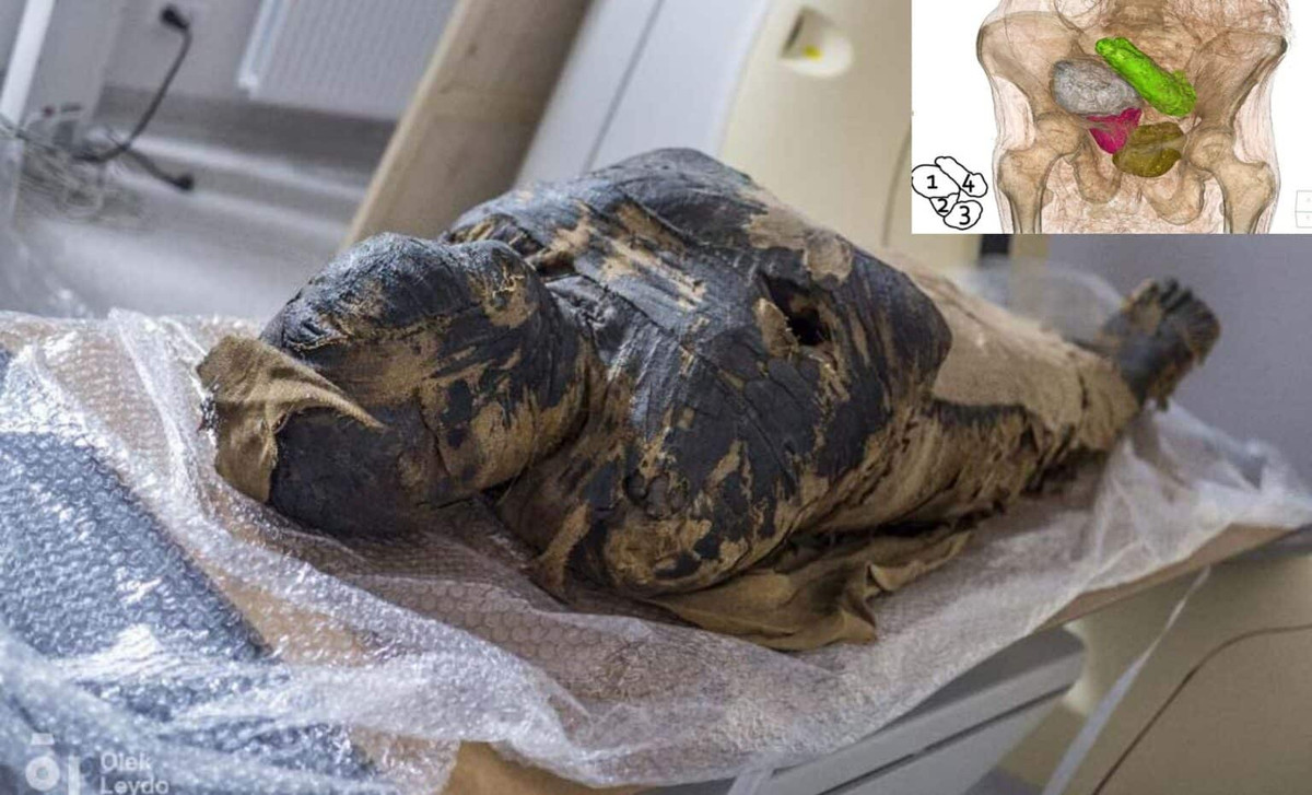 Vào năm 2021, các chuyên gia thuộc Dự án Xác ướp Warsaw đã kết luận rằng, trái ngược với giả định trước đó cho rằng xác ướp là của một linh mục nam thì thi hài này thực chất thuộc về một phụ nữ ngoài 20 tuổi, đang mang thai từ 6,5 - 7,5 tháng. Ảnh: Shutterstock.