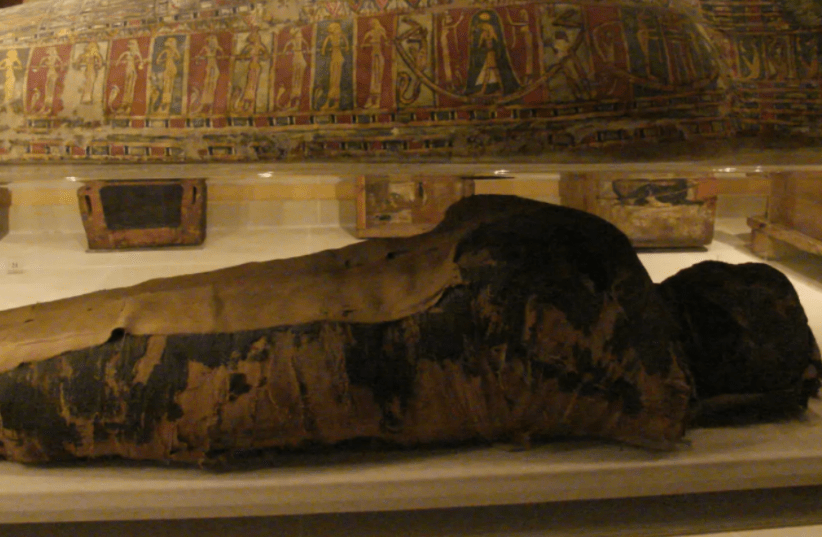 Trong nghiên cứu đầu tiên được công bố về xác ướp, các nhà nghiên cứu đã sử dụng hình ảnh chụp X-quang và chụp CT để xác định một số bó cơ quan ướp xác trong bụng của "Quý bà bí ẩn". Họ cũng cho rằng có thể nhìn thấy một thai nhi được bảo quản kém, khoảng 28 tuần tuổi thai, trên các lần chụp X-quang và chụp CT. Ảnh: Wikimedia Commons.