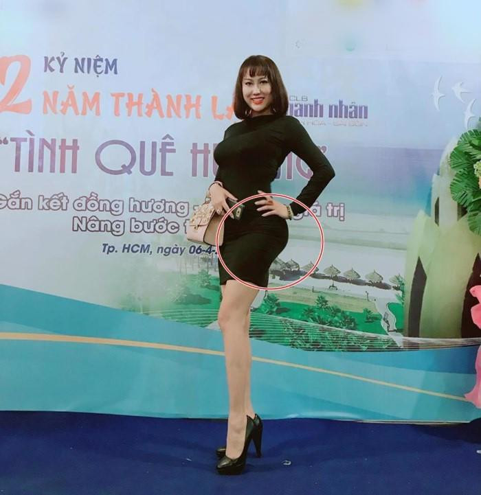 Dù đầu tư khá tốn kém cho cuộc đại tu nhan sắc lần này nhưng có vẻ như vòng 3 của Phi Thanh Vân trong thời gian gần đây lại bị méo mó, biến dạng. Ảnh: Khám Phá.