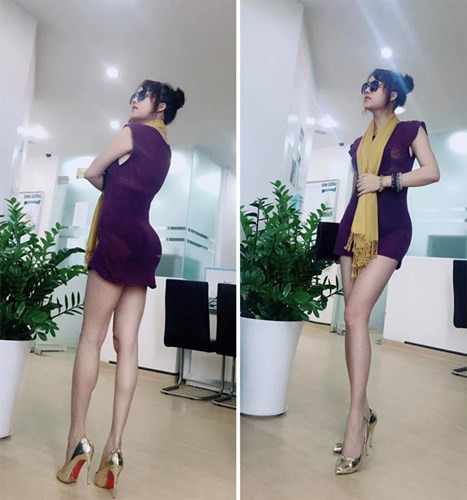 Gần đây nhất, “nữ hoàng dao kéo” khiến nhiều người choáng váng khi quyết đại phẫu lại vòng 1 và vòng 3 để có thân hình “đồng hồ cát” như mơ ước. Sau khi phẫu thuật, "nữ hoàng dao kéo" đã rất hào hứng chia sẻ những hình ảnh vòng 3 khủng 104cm của mình, bên cạnh vòng 1 là 93 và vòng 2 60. Ảnh: Baogiaothong.