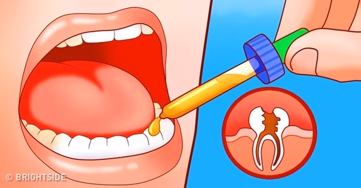 Cỏ xạ hương thường được dùng để giảm đau, viêm, sốt và có thể điều trị đau khi mọc răng khôn. Bạn có thể pha loãng một vài giọt tinh dầu cỏ xạ hương vào dầu nền, sau đó dùng bông gòn hay ngón tay để thoa vào răng và nướu. Ảnh: Internet. 