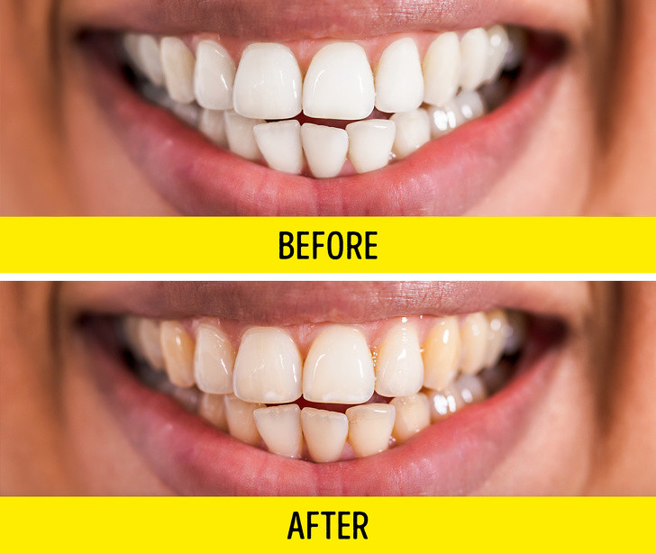 8 tac dung phu cua thuoc khang sinh ma bac si it khi noi ra-Hinh-2