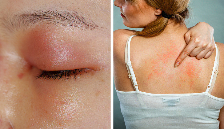 8 tac dung phu cua thuoc khang sinh ma bac si it khi noi ra-Hinh-4