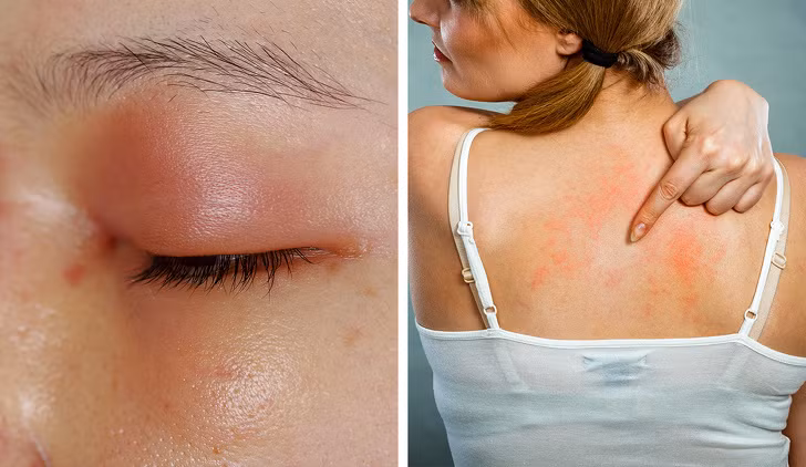 8 tac dung phu cua thuoc khang sinh ma bac si it khi noi ra-Hinh-4