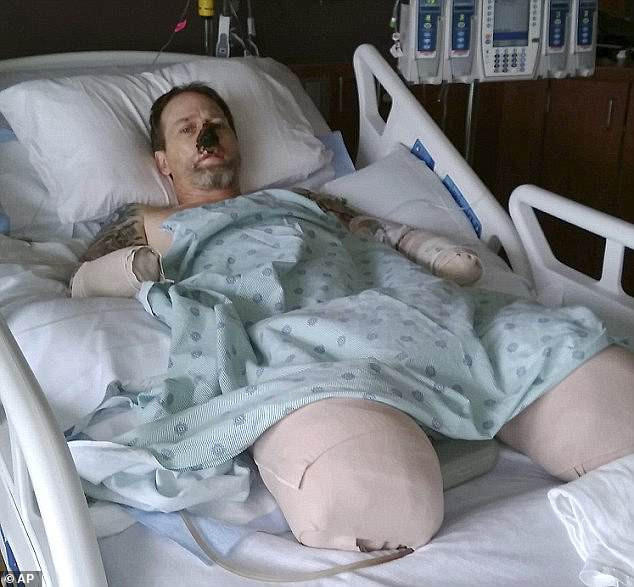 Qua các xét nghiệm máu, bác sĩ phát hiện Greg đã nhiễm vi khuẩn gây bệnh được gọi là capnocytophaga canimorsus. Theo Viện Y tế Quốc gia Hoa Kỳ (NIH), vi khuẩn này được tìm thấy trong nước bọt của chó và mèo khỏe mạnh.