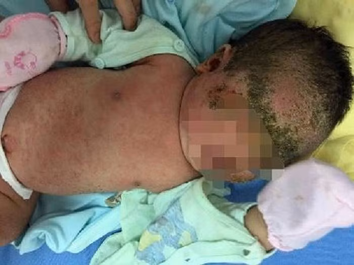 Hiem hoa tiem an khi tam bang la cho tre