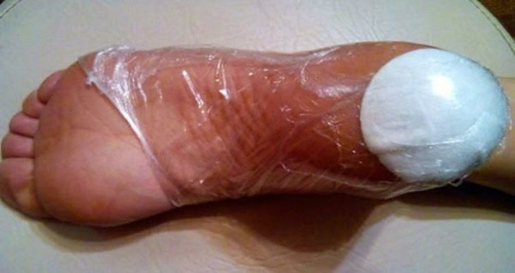 Da chân bị khô có thể là do thiếu vitamin A và E. Nó cũng có thể do sự hiện diện của việc bị nhiễm nấm. Nếu tình trạng da khô và gồ ghề không biến mất ngay cả bạn bổ sung đủ lượng vitamin, đây có thể là dấu hiệu của sự gián đoạn nội tiết.