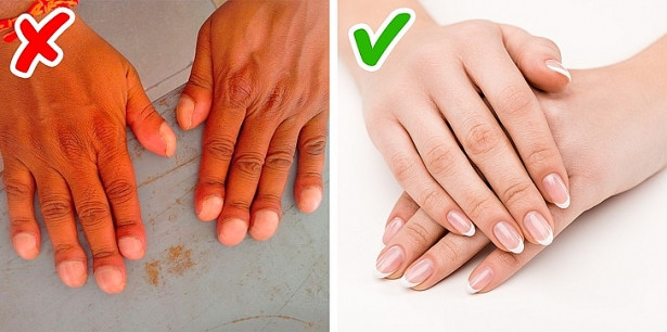 Móng tay to hơn: Nếu bạn nhận thấy rằng móng tay của mình đang thay đổi hình dạng và trở nên dày hơn hay rộng hơn, điều này có thể chỉ ra rằng bạn có vấn đề về tim.