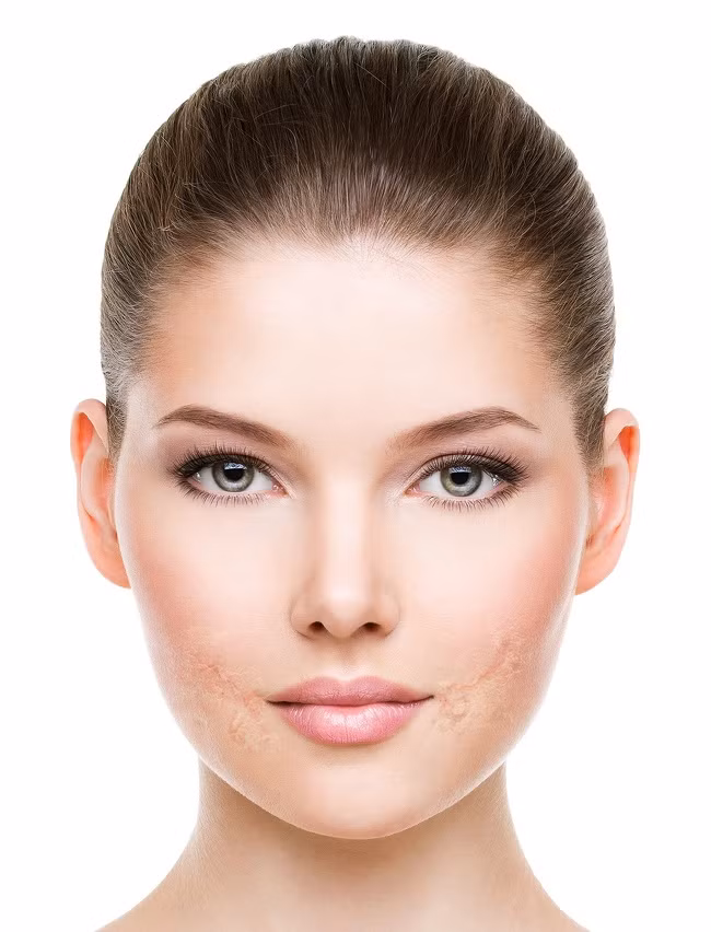 Kem dưỡng da tay làm khô và gây dị ứng: So với da tay thì da mặt mỏng manh và mẩn cảm hơn. Do đó, đừng bao giờ sử dụng kem tay thoa lên mặt, điều này có thể làm tắc nghẽn lỗ chân lông và gây viêm.