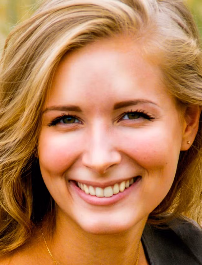 Rượu làm da bóng dầu: Nhiều người bị mụn nhọt nghĩ rằng rượu có thể giúp họ thoát khỏi vấn đề này. Tuy nhiên, rượu lại làm phá hủy lớp bảo vệ da khỏi vi khuẩn, bụi bẩn và các yếu tố khác.