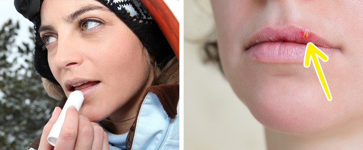 Son dưỡng môi: Virus herpes có thể được truyền từ người này sang người khác khi dùng chung son dưỡng hoặc son môi, ngay cả khi người mang mầm bệnh không có triệu chứng rõ ràng của bệnh.