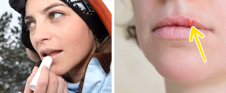 Son dưỡng môi: Virus herpes có thể được truyền từ người này sang người khác khi dùng chung son dưỡng hoặc son môi, ngay cả khi người mang mầm bệnh không có triệu chứng rõ ràng của bệnh.