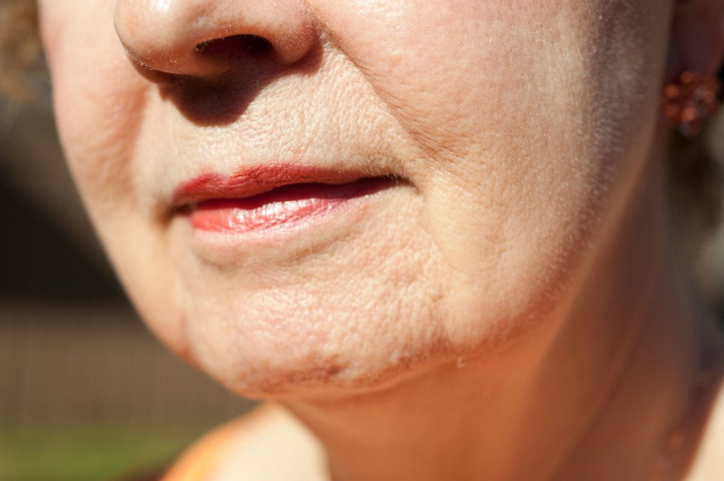 Nếp nhăn: Mặc dù không thể tránh được quá trình lão hóa, nhưng bạn hoàn toàn có thể kiểm soát được những nếp nhăn trên da. Nếu da của bạn có nếp nhăn sớm, hãy lưu ý: Tăng cường bổ sung vitamin C để thúc đẩy sự hình thành collagen - một protein cấu tạo nên da. Hãy tăng cường tiêu thụ thực phẩm chứa nhiều vitamin C như: Đu đủ, ớt chuông, bông cải xanh, dâu tây và dứa.