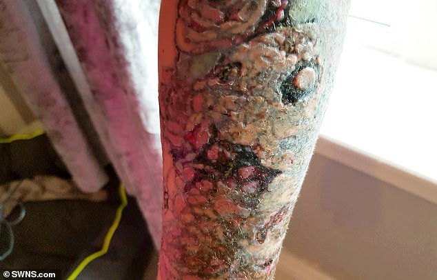 Hinh anh ron nguoi khi pha bo hinh xam-Hinh-6