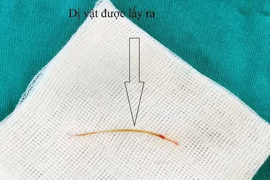 Kinh hai nhung vu hoc xuong nguy kich phai nhap vien cap cuu-Hinh-4