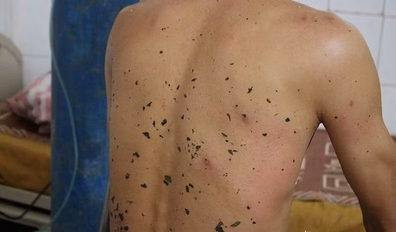 Nhung truong hop ong dot chet nguoi thuong tam