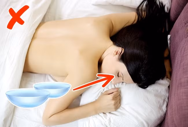 Quên tháo kính áp tròng khi ngủ: Giác mạc nhận được oxy từ không khí khi chúng ta tỉnh táo và nó nhận được hơi ẩm từ nước mắt khi chúng ta đang ngủ. Nhưng khi bạn đeo kính áp tròng suốt 24 giờ, giác mạc không nhận được các yếu tố cần thiết, vì vậy nó trở nên yếu hơn. Ảnh: BS. 