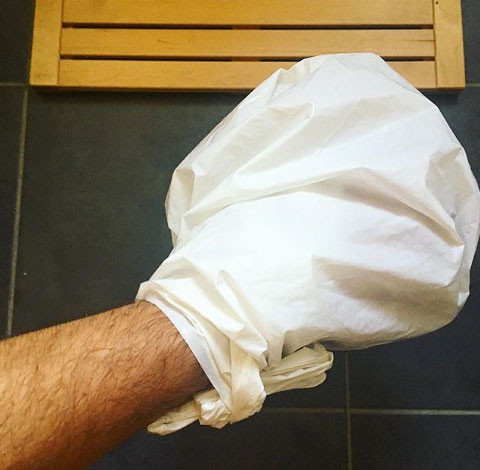 Túi nilon: Sau khi làm mát vết bỏng, hãy bọc nó bằng túi nilon để ngăn ngừa nhiễm trùng.