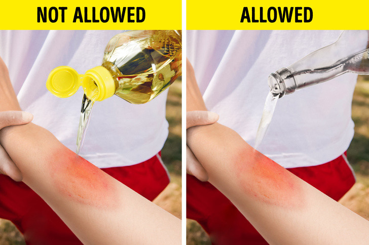 Nước trái cây hoặc sữa: Với vết bỏng, bạn phải hạ nhiệt vết bỏng càng nhanh càng tốt. Các chuyên gia khuyên bạn nên để vùng bỏng xả dưới nước máy trong vòng 10-15 phút. Tuy nhiên, trong trường hợp không có vòi nước gần đó, bạn có thể dùng sữa hoặc nước trái cây để thay thế.