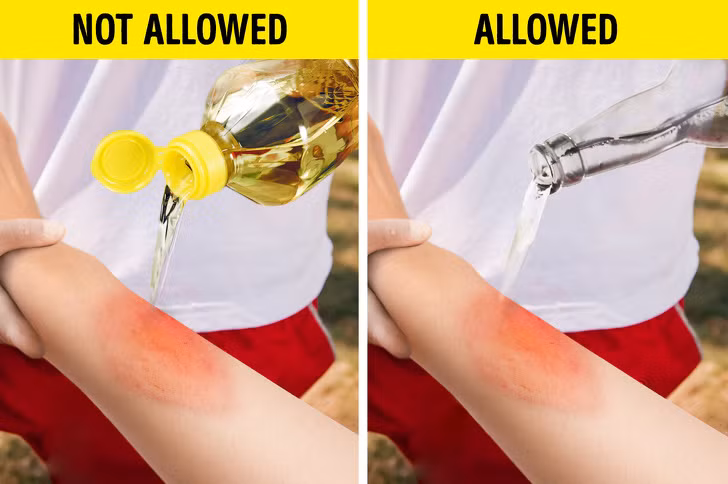 Nước trái cây hoặc sữa: Với vết bỏng, bạn phải hạ nhiệt vết bỏng càng nhanh càng tốt. Các chuyên gia khuyên bạn nên để vùng bỏng xả dưới nước máy trong vòng 10-15 phút. Tuy nhiên, trong trường hợp không có vòi nước gần đó, bạn có thể dùng sữa hoặc nước trái cây để thay thế.