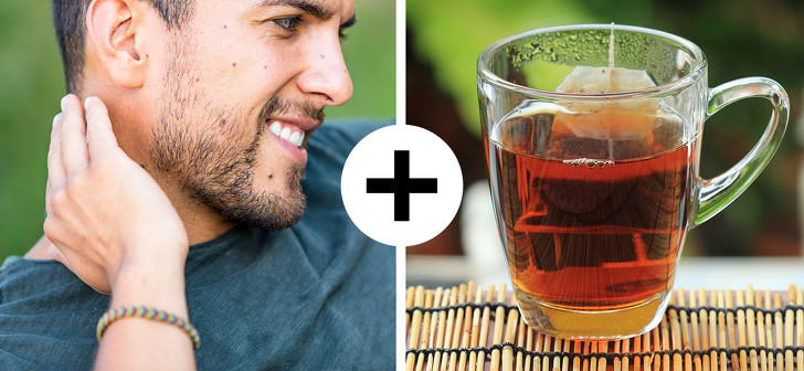 Túi trà: Các chất tannin trong trà có đặc tính kháng viêm và có thể loại bỏ kích ứng sau khi bị côn trùng cắn. Pha một túi trà, để nguội và đặt lên vùng côn trùng cắn.