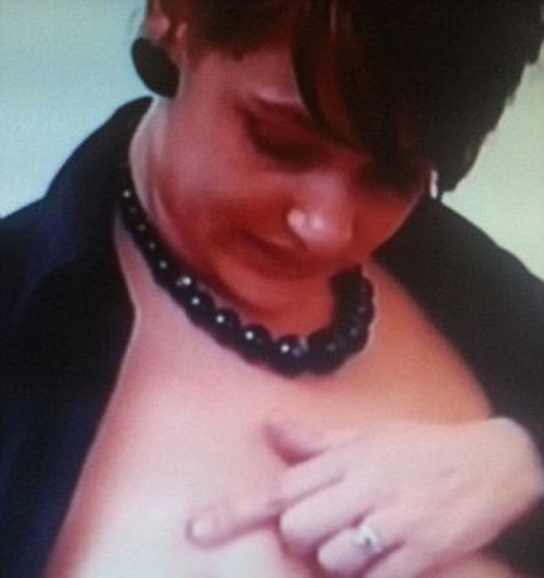 Tháng 4/2008, một người mẹ 30 tuổi ở Nottinghamshire đã quyết định nhờ tới “dao kéo” vì muốn tân trang lại bộ ngực nhăn nheo, chảy xệ sau khi sinh. Ca phẫu thuật nâng ngực tiêu tốn gần 150 triệu đồng. Nhưng chỉ hai ngày sau đó, những lổ hở trên ngực đã khiến chất lỏng bơm vào bị chảy ra ngoài.