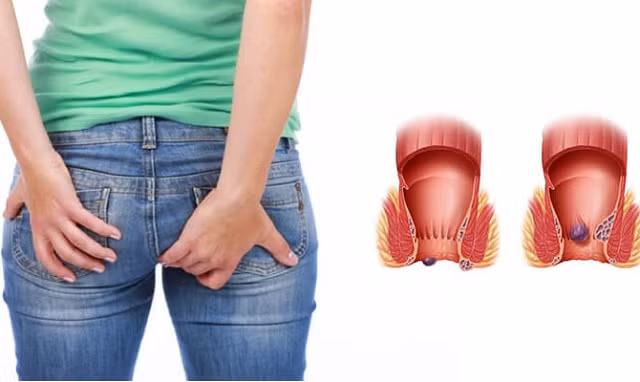 Nhung dau hieu canh bao benh tri ma dan van phong nen bo tui