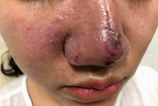 Kinh hoang bien chung phau thuat tham my dang so nam 2018-Hinh-2