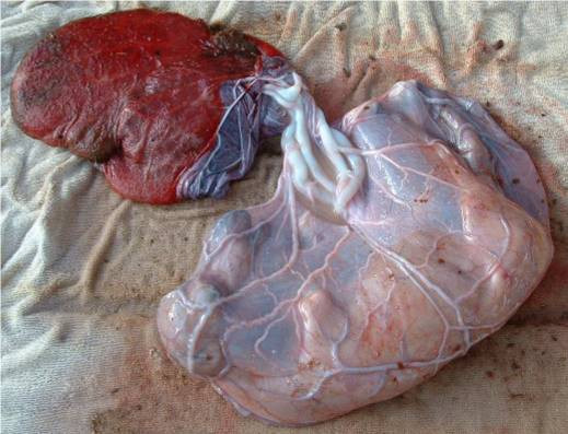 Dùng nhau thai ngựa: Đối với những người có vấn đề về da, từ mụn trứng cá đến bệnh vẩy nến, nhau thai ngựa có thể giúp điều trị. Ở Hà Lan, các cầu thủ bóng đá thậm chí còn điều trị rách dây chằng mắt cá chân bằng cách sử dụng nhau thai ngựa.