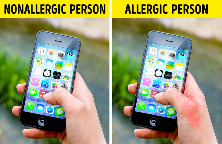 Điện thoại, máy tính bảng: Một số người bị dị ứng với niken hoặc coban, những kim loại được sử dụng trong phần lớn các mẫu điện thoại hiện đại. Khi sử dụng các thiết bị này, họ sẽ gặp phải tình trạng ngứa, phát ban trên tay, tai và má. Nếu có những triệu chứng này, hãy cố gắng nói chuyện điện thoại ít hơn hoặc hãy sử dụng loa ngoài.