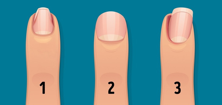 Thay doi mong tay canh bao tinh trang suc khoe nghiem trong-Hinh-3