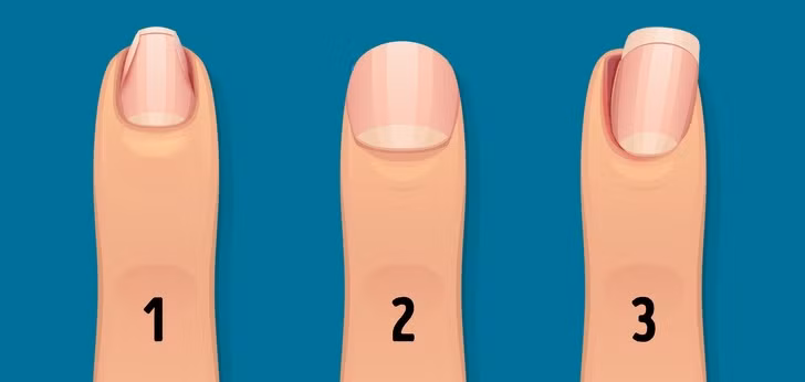 Thay doi mong tay canh bao tinh trang suc khoe nghiem trong-Hinh-3