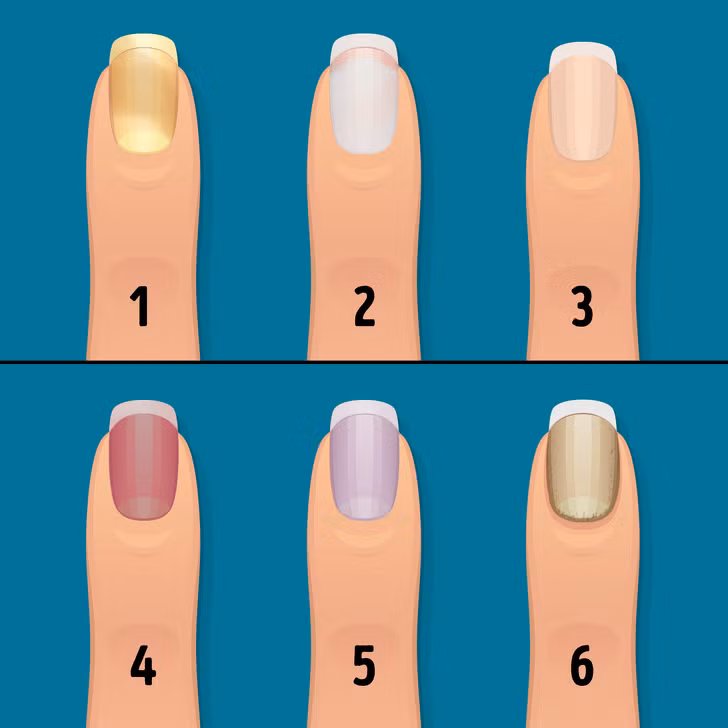 Thay doi mong tay canh bao tinh trang suc khoe nghiem trong