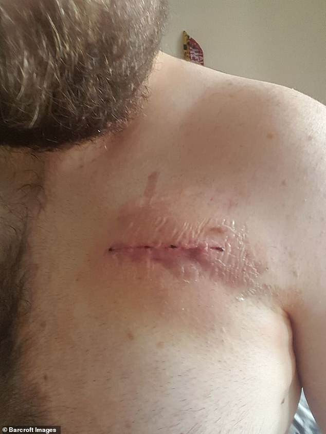 Từ đó đến nay, anh đã 9 lần bị ngừng tim và anh tin rằng mình đã có mọi trải nghiệm cận tử, từ việc ngoài cơ thể nhìn thấy “ánh sáng trắng” và “ánh sáng vàng”. Anh gọi nó là “tám giây chết” khi anh ấy biết điều gì sắp tới nhưng không thể làm gì được. Ảnh: BS.