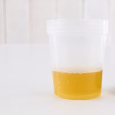 Nước tiểu: Kem dưỡng da thường chứa thành phần cho "urê". Urê là một chất làm mềm và chất làm tan keratolytic, giúp dưỡng da khô, vảy.