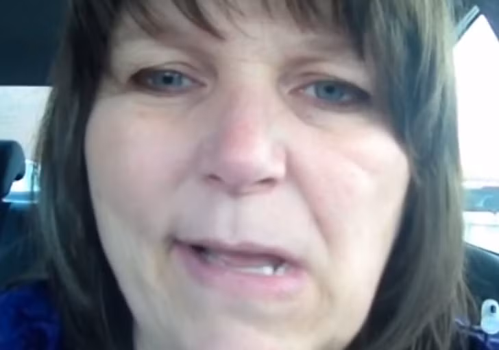 Tái mặt, ủ rũ: Người bị đột quỵ thường có khuôn mặt trông mệt mỏi, ủ rũ, da nhợt nhạt. Các nhân viên y tế thường dựa trên dấu hiệu này để xác định xem bệnh nhân có bị đột quỵ không bằng cách yêu cầu họ mỉm cười. Nếu thấy da chùng xuống, mặt yếu dần thì có thể họ đang trong cơn đột quỵ.