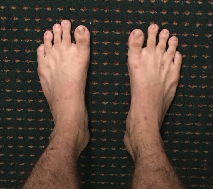 Với đôi bàn chân này, những ngón chân cái không phải là to cao nhất.