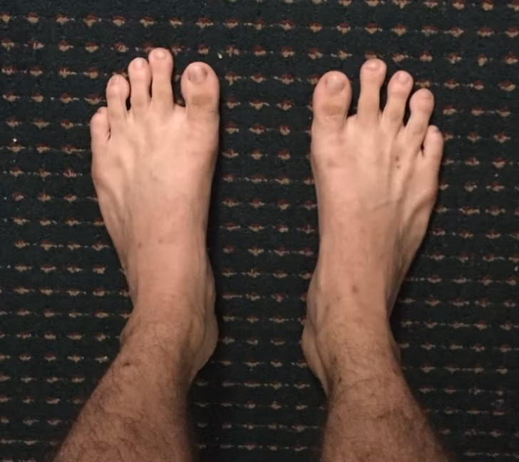 Với đôi bàn chân này, những ngón chân cái không phải là to cao nhất.