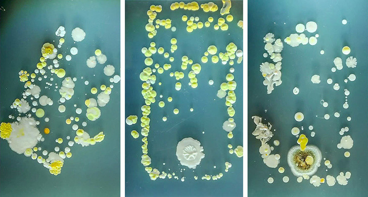 Nói chuyện điện thoại với tai nghe: Giữ chiếc điện thoại cách xa khỏi khuôn mặt là điều tốt nhất bạn có thể làm để bảo vệ làn da của mình. Nghiên cứu đã chỉ ra rằng một màn hình điện thoại thông minh có vi khuẩn nhiều hơn 18 lần so với nhà vệ sinh trong một phòng tắm công cộng. Ảnh: BS. 