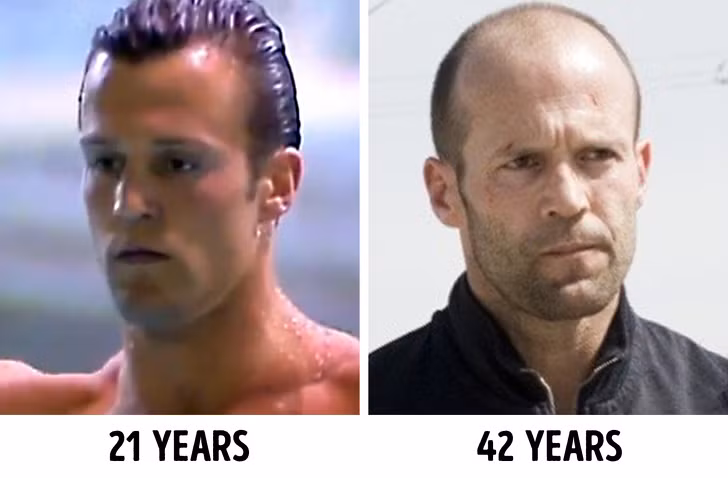 Khi bước qua tuổi 40, tóc của chúng ta sẽ mỏng đi: Vấn đề này xảy ra chủ yếu ở nam giới. Thậm chí, nhiều người đã bắt đầu rụng tóc trước khi họ bước sang tuổi 30 và 53% đàn ông bị hói sau 40 tuổi. Phụ nữ cũng rụng tóc nhưng chậm hơn đàn ông.