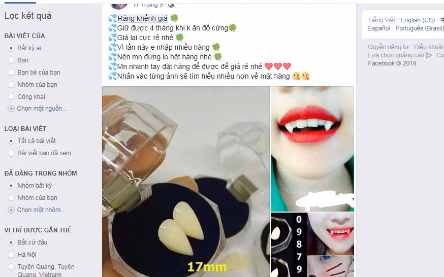 Nguy hiểm tiềm ẩn từ trào lưu mua răng khểnh giả tự lắp Nguy hiem tiem an tu trao luu mua rang khenh gia tu lap