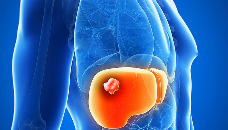 Cach phong can benh ma tieu thuyet gia Kim Dung mac-Hinh-2