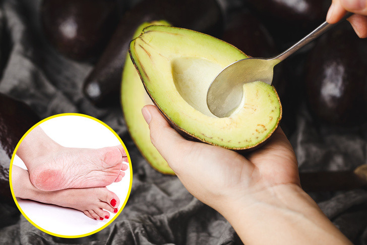 Dưỡng mềm gót chân: Trái bơ giúp làm mềm gót chân nứt nẻ hiệu quả. Công thức: Trộn 1 muỗng canh muối, 1 muỗng canh đường, 2 giọt tinh dầu cam và phần thịt của 1/2 quả bơ. Ngâm chân trong nước ấm cho mềm rồi dùng hỗn hợp massage. Để yên 10 - 15 phút rồi rửa sạch với nước ấm, thoa kem dưỡng ẩm và mang tất ấm. Lặp lại 2 lần/tuần.