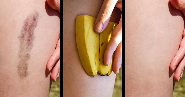 Chuối rất giàu kali, vitamin C và B6, có lợi cho sức khoẻ tim mạch. Lượng kali cao làm giảm nguy cơ mắc bệnh tim mạch và đột quỵ. Chuối sẽ cung cấp hỗ trợ tốt cho hệ tiêu hóa của bạn trong trường hợp tiêu chảy.