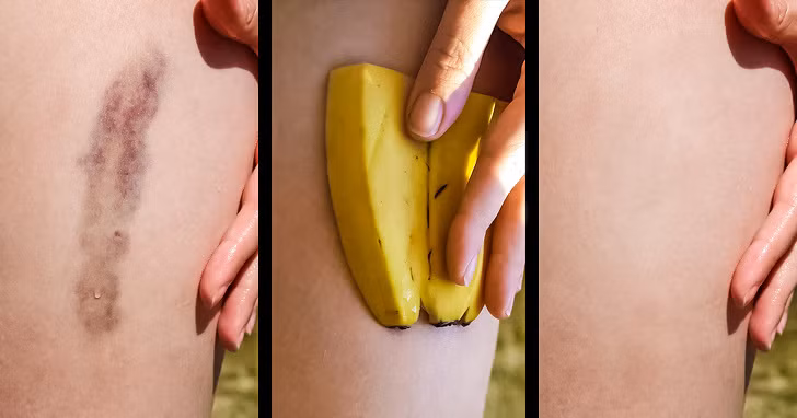 Chuối rất giàu kali, vitamin C và B6, có lợi cho sức khoẻ tim mạch. Lượng kali cao làm giảm nguy cơ mắc bệnh tim mạch và đột quỵ. Chuối sẽ cung cấp hỗ trợ tốt cho hệ tiêu hóa của bạn trong trường hợp tiêu chảy.