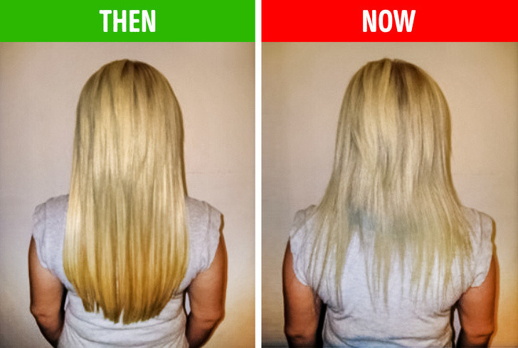 Tóc nhờn, chẻ ngọn, thưa và bạc sớm: Đây là dấu hiệu phản ánh cơ thể đang thiếu chất. Tóc thưa là do thiếu sắt, kẽm, protein và vitamin C trong chế độ ăn hàng ngày. Chế độ ăn uống không cung cấp đủ dưỡng chất khiến tóc thiếu protein để nuôi dưỡng nên càng ngày càng khô, chẻ ngọn và xơ.