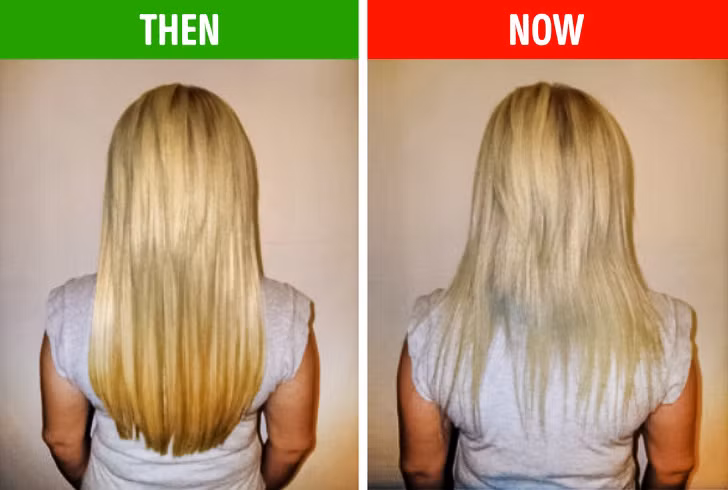 Tóc nhờn, chẻ ngọn, thưa và bạc sớm: Đây là dấu hiệu phản ánh cơ thể đang thiếu chất. Tóc thưa là do thiếu sắt, kẽm, protein và vitamin C trong chế độ ăn hàng ngày. Chế độ ăn uống không cung cấp đủ dưỡng chất khiến tóc thiếu protein để nuôi dưỡng nên càng ngày càng khô, chẻ ngọn và xơ.