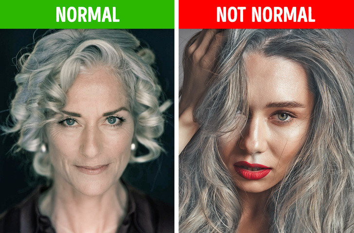 Tóc bạc gần trán: Những ai có bệnh ở dạ dày như đau rát dạ dày, đau bụng, trướng bụng, nhạt miệng hay táo bón, thì tóc gần trán hay bị bạc.