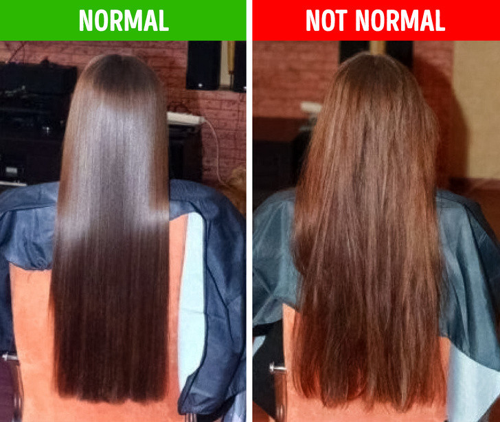 Màu tóc nhạt dần dù không nhuộm tóc: Thói quen không bảo vệ tóc khi đi ngoài đường là nguyên nhân phổ biến khiến mái tóc bị đổi màu do tác hại từ ánh nắng mặt trời. Tuy nhiên, đây cũng có thể là dấu hiệu cảnh báo cơ thể đang thiếu vitamin E và bạn cần bổ sung ngay lập tức.