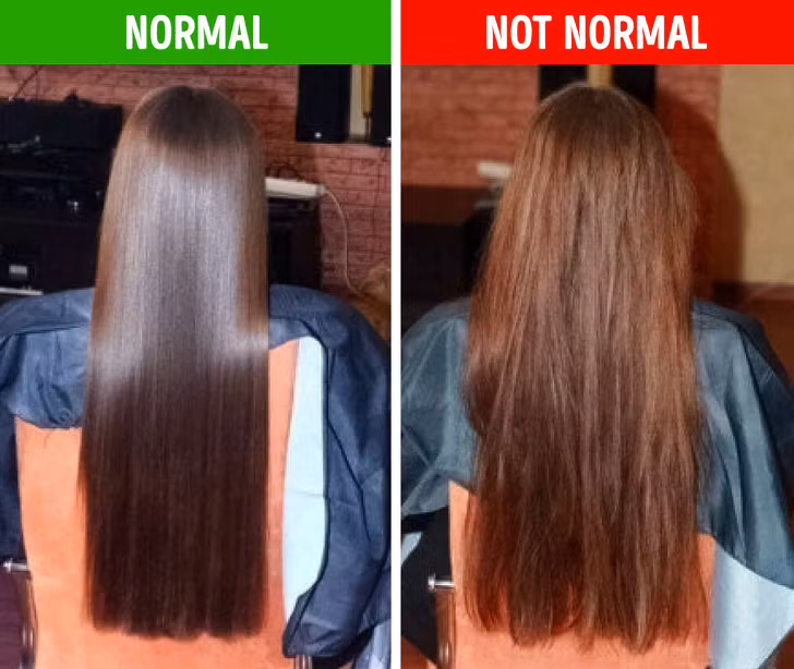 Màu tóc nhạt dần dù không nhuộm tóc: Thói quen không bảo vệ tóc khi đi ngoài đường là nguyên nhân phổ biến khiến mái tóc bị đổi màu do tác hại từ ánh nắng mặt trời. Tuy nhiên, đây cũng có thể là dấu hiệu cảnh báo cơ thể đang thiếu vitamin E và bạn cần bổ sung ngay lập tức.